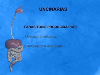 UNCINARIAS
PARASITOSIS PRODUCIDA POR:
1.Necator americanus
2.Ancylostoma duodenale
 