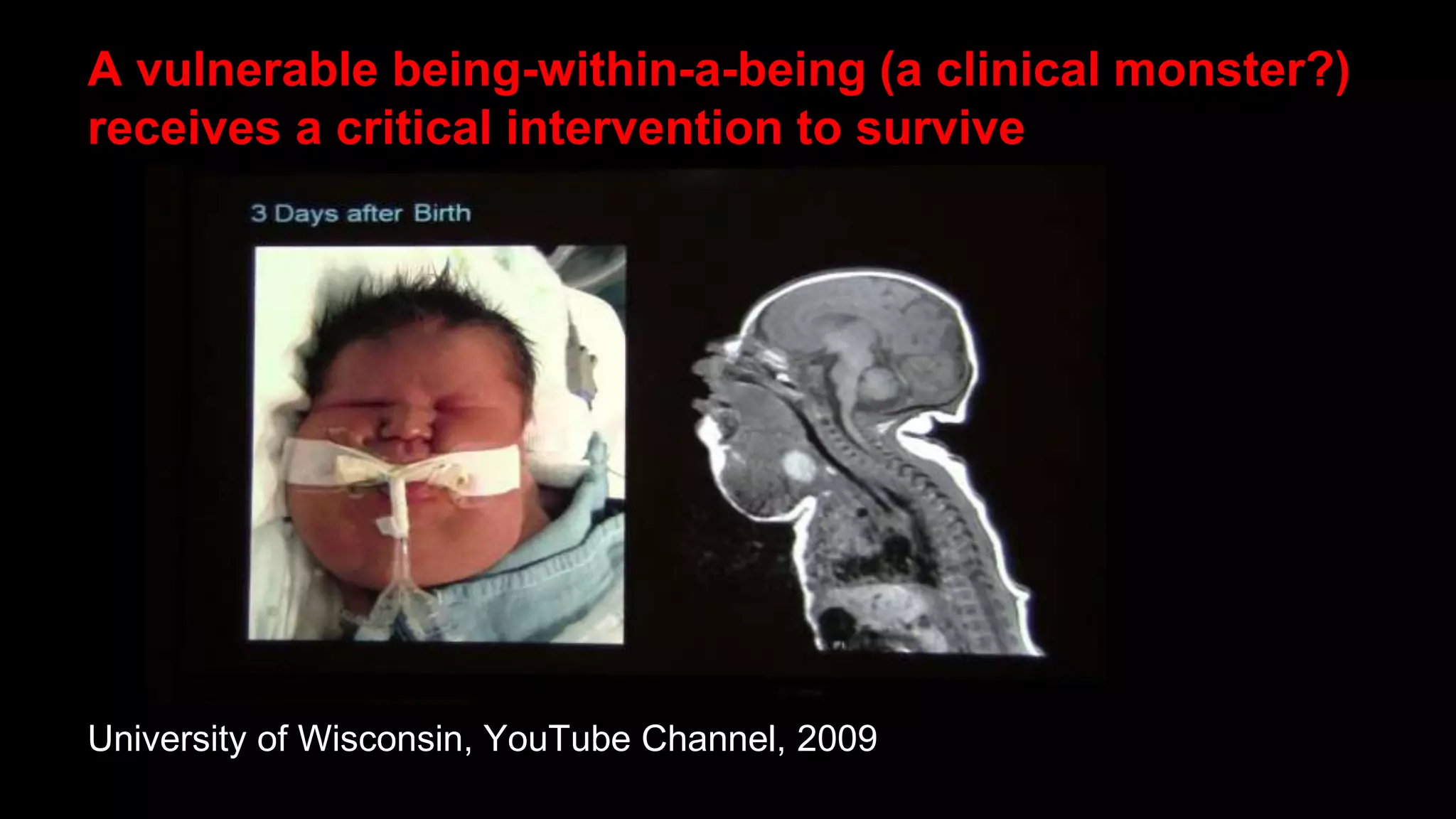 A vulnerable being-within-a-being (a clinical monster?)
receives a critical intervention to survive
University of Wisconsin, YouTube Channel, 2009
 