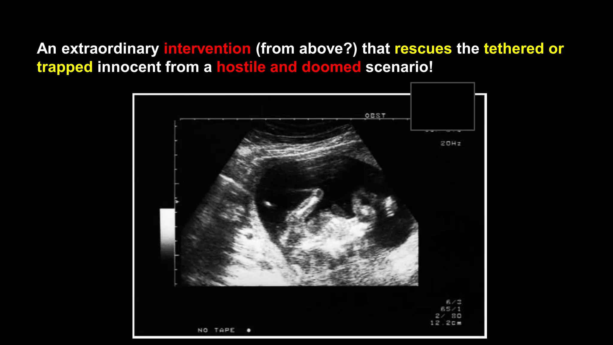 An extraordinary intervention (from above?) that rescues the tethered or
trapped innocent from a hostile and doomed scenario!
 
