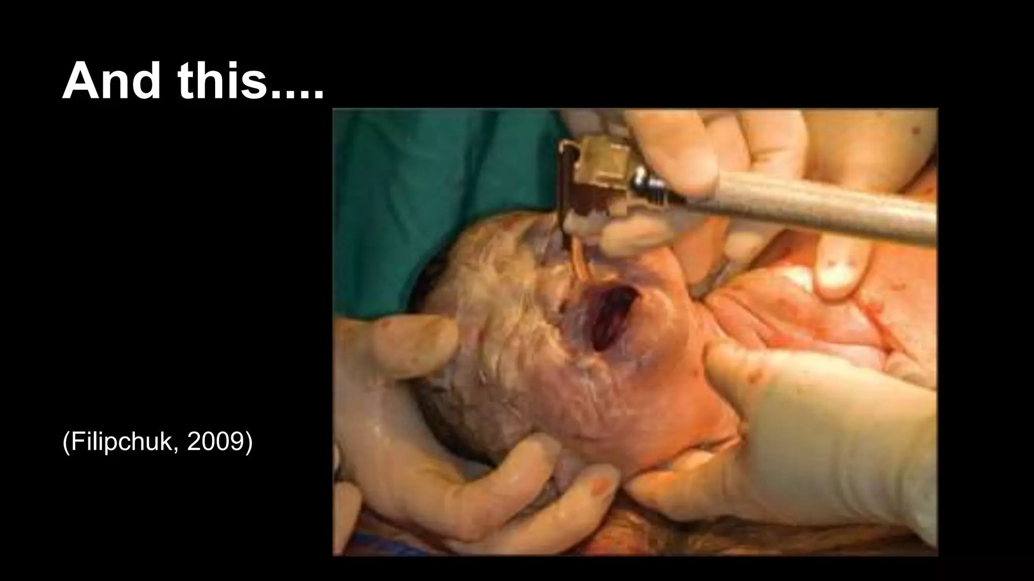 And this....
(Filipchuk, 2009)
 