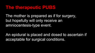 The therapeutic PUBS
The mother is prepared as if for surgery,
but hopefully will only receive an
amniocentesis-type event.
An epidural is placed and dosed to ascertain if
acceptable for surgical conditions.
 