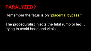 PARALYZED?
Remember the fetus is on “placental bypass.”
The proceduralist injects the fetal rump or leg…
trying to avoid head and vitals...
 
