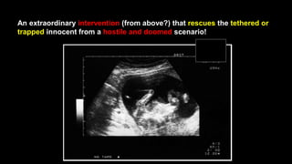 An extraordinary intervention (from above?) that rescues the tethered or
trapped innocent from a hostile and doomed scenario!
 