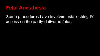 Fetal Anesthesia
Some procedures have involved establishing IV
access on the partly-delivered fetus.
 