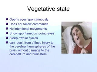 Vegetative state
Opens eyes spontaneously
Does not follow commands
No intentional movements
Show spontaneous roving eyes
Sleep awake cycles
can result from diffuse injury to
the cerebral hemispheres of the
brain without damage to the
cerebellum and brainstem
 