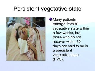 Persistent vegetative state
Many patients
emerge from a
vegetative state within
a few weeks, but
those who do not
recover within 30
days are said to be in
a persistent
vegetative state
(PVS).
 