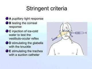Stringent criteria
A pupillary light response
B testing the corneal
response
C injection of ice-cold
water to test the
vestibulo-ocular reflex
D stimulating the glabella
with the knuckle
E stimulating the trachea
with a suction catheter
 