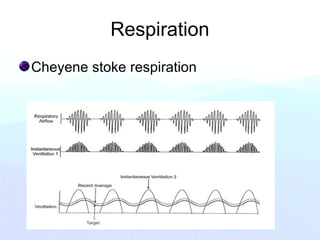 Respiration
Cheyene stoke respiration
 