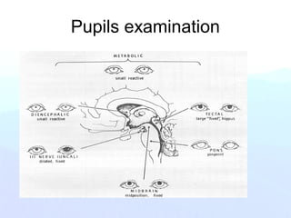 Pupils examination
 