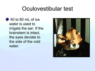 Oculovestibular test
40 to 60 mL of ice
water is used to
irrigate the ear. If the
brainstem is intact,
the eyes deviate to
the side of the cold
water.
 