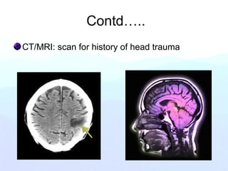Contd…..
CT/MRI: scan for history of head trauma
 