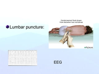 Lumbar puncture:
EEG
 