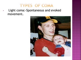 • Light coma:-Spontaneous and evoked
movement.
 
