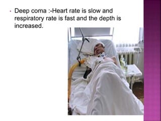• Deep coma :-Heart rate is slow and
respiratory rate is fast and the depth is
increased.
 