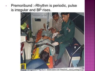 • Premoribund :-Rhythm is periodic, pulse
is irregular and BP rises.
 