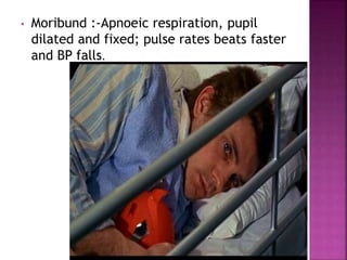 • Moribund :-Apnoeic respiration, pupil
dilated and fixed; pulse rates beats faster
and BP falls.
 