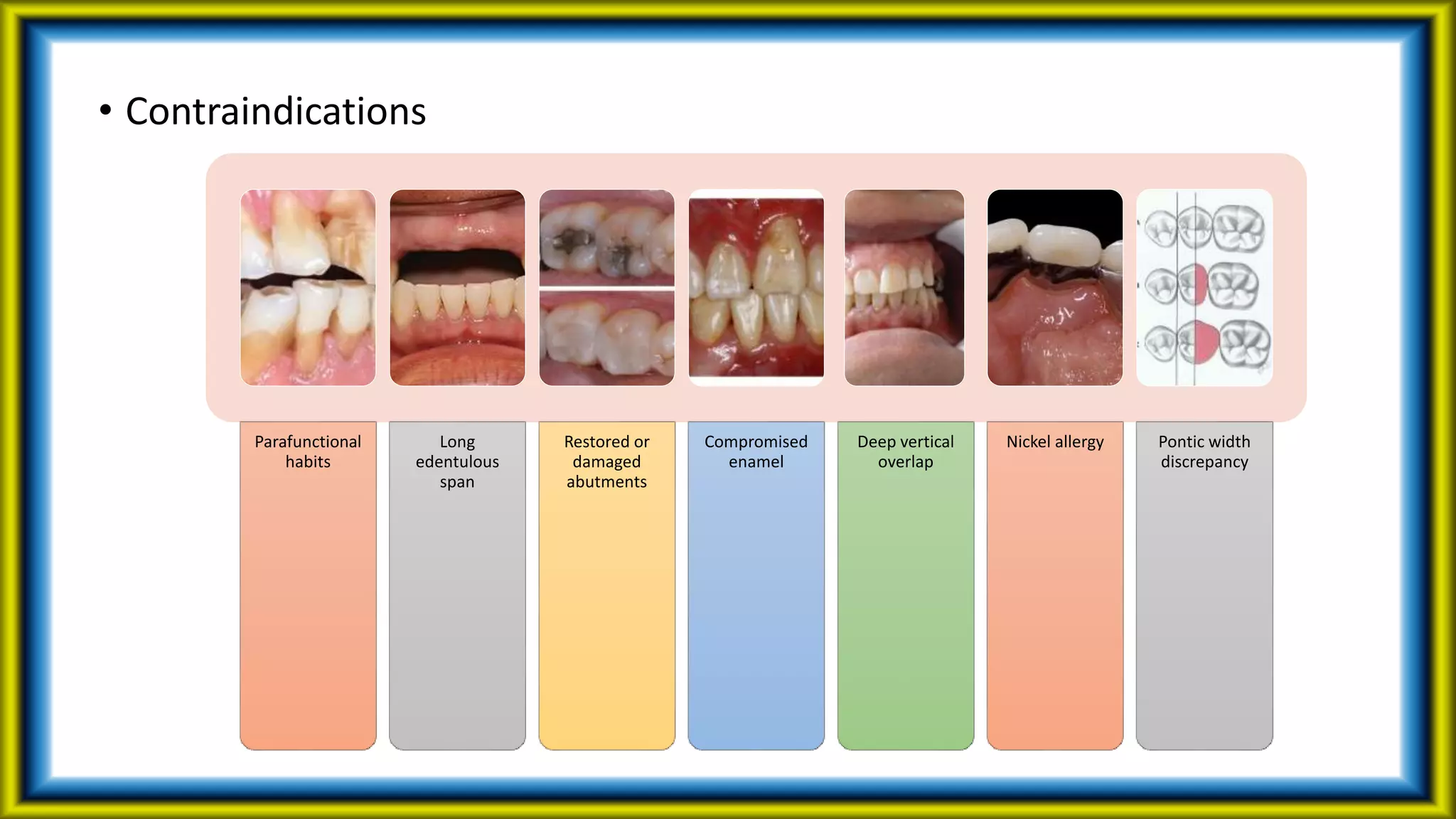 • Contraindications
Parafunctional
habits
Long
edentulous
span
Restored or
damaged
abutments
Compromised
enamel
Deep vertical
overlap
Nickel allergy Pontic width
discrepancy
 