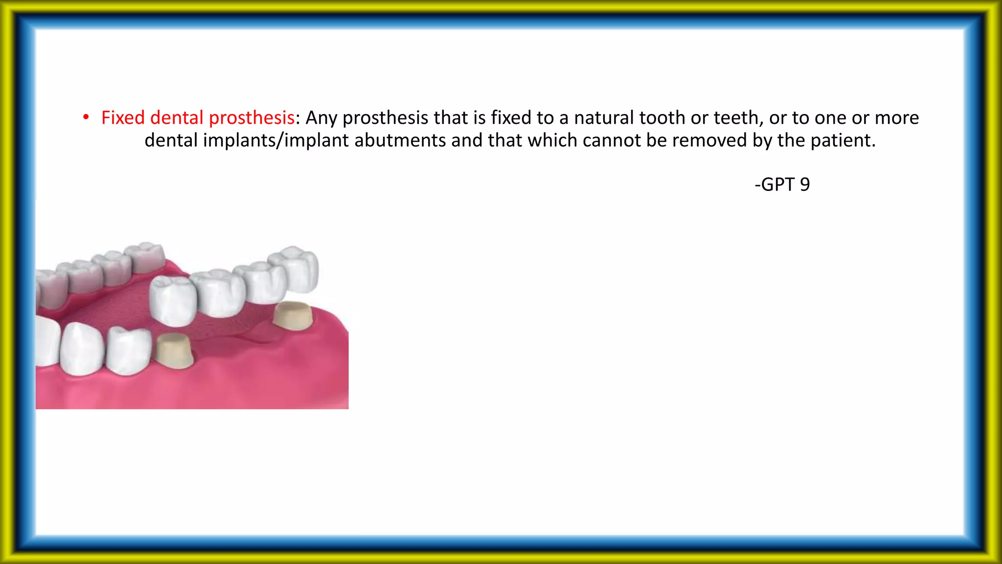 • Fixed dental prosthesis: Any prosthesis that is fixed to a natural tooth or teeth, or to one or more
dental implants/implant abutments and that which cannot be removed by the patient.
-GPT 9
 
