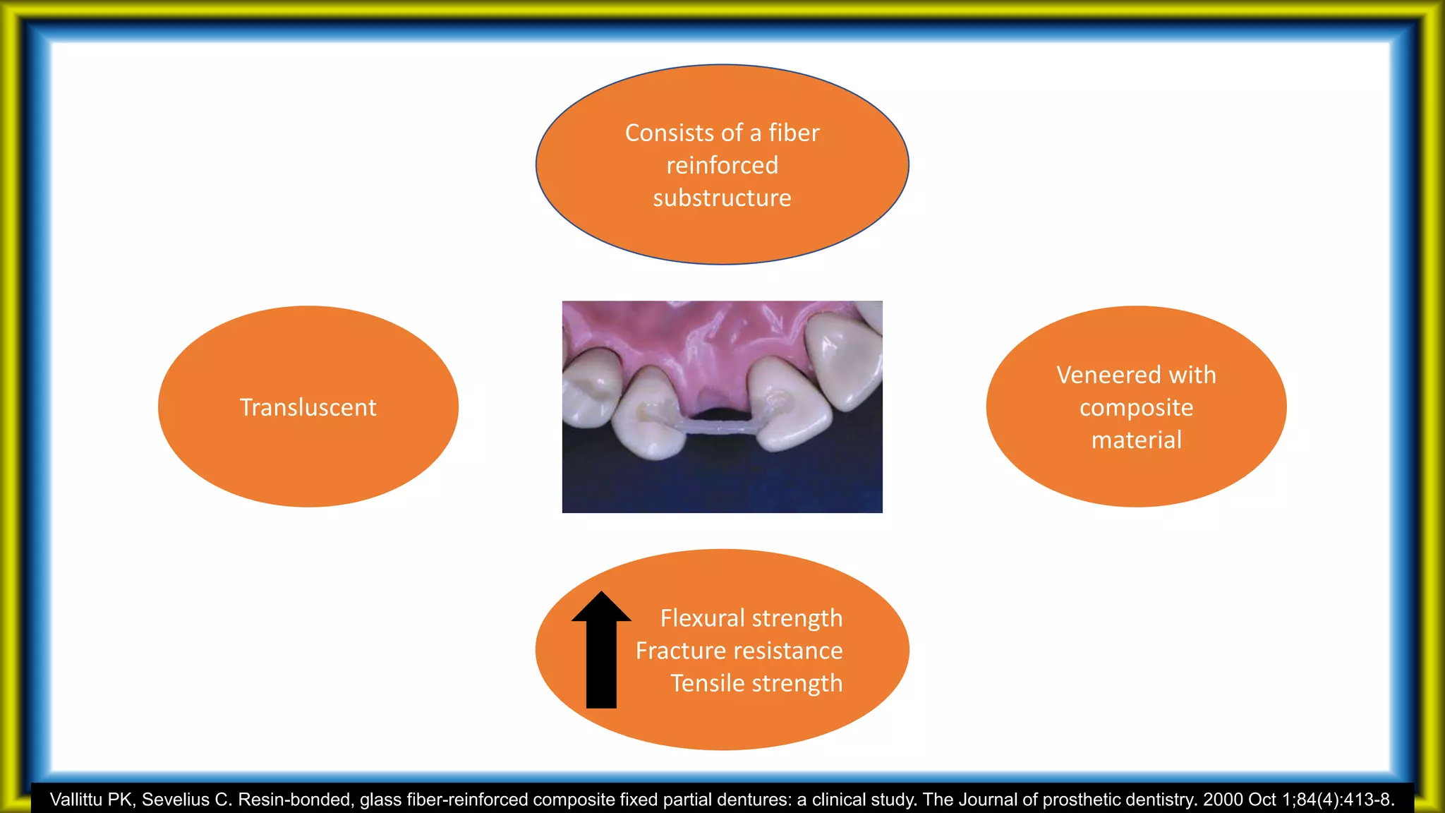 Consists of a fiber
reinforced
substructure
Veneered with
composite
material
Flexural strength
Fracture resistance
Tensile strength
Transluscent
Vallittu PK, Sevelius C. Resin-bonded, glass fiber-reinforced composite fixed partial dentures: a clinical study. The Journal of prosthetic dentistry. 2000 Oct 1;84(4):413-8.
 