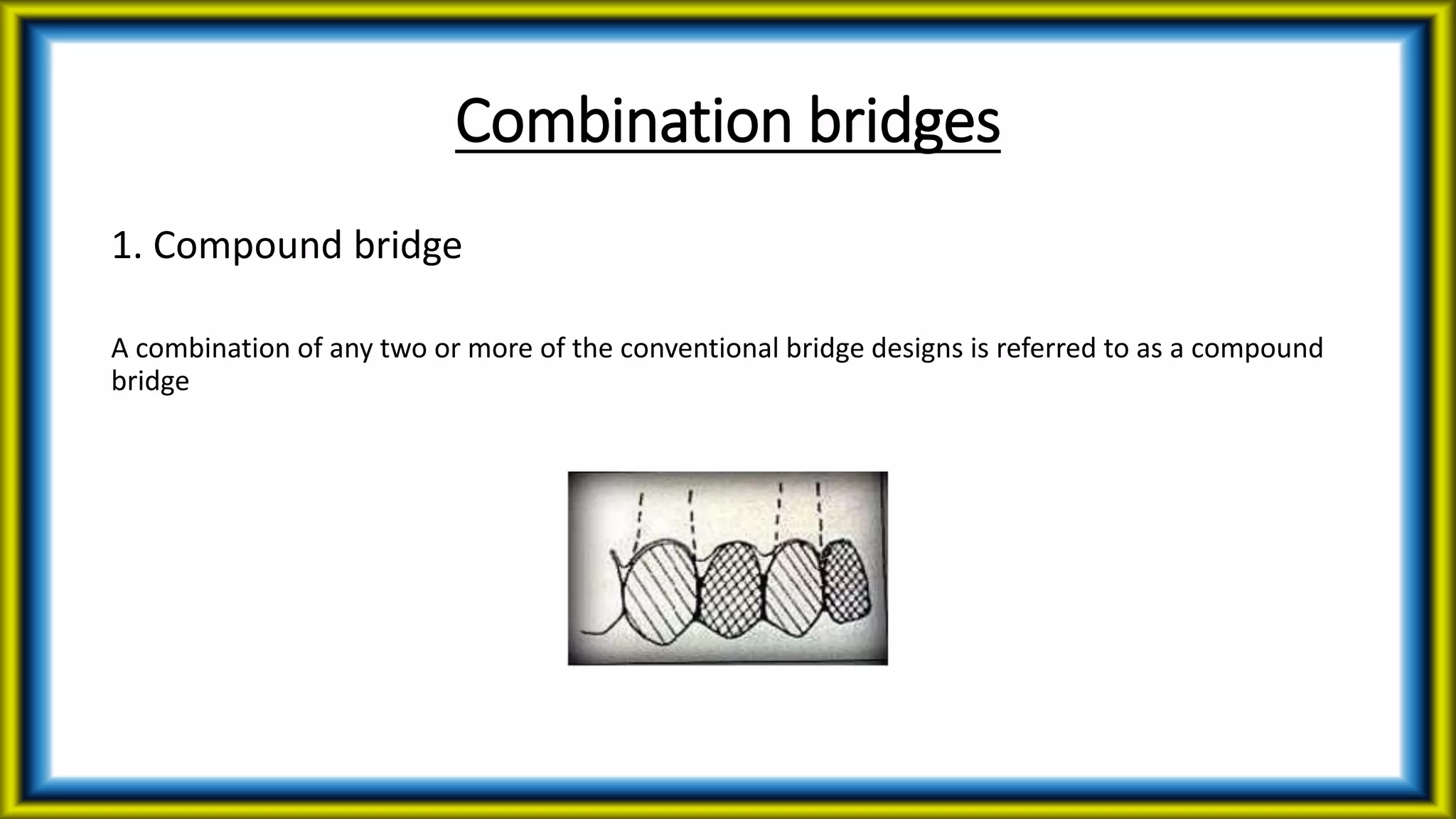 Combination bridges
1. Compound bridge
A combination of any two or more of the conventional bridge designs is referred to as a compound
bridge
 