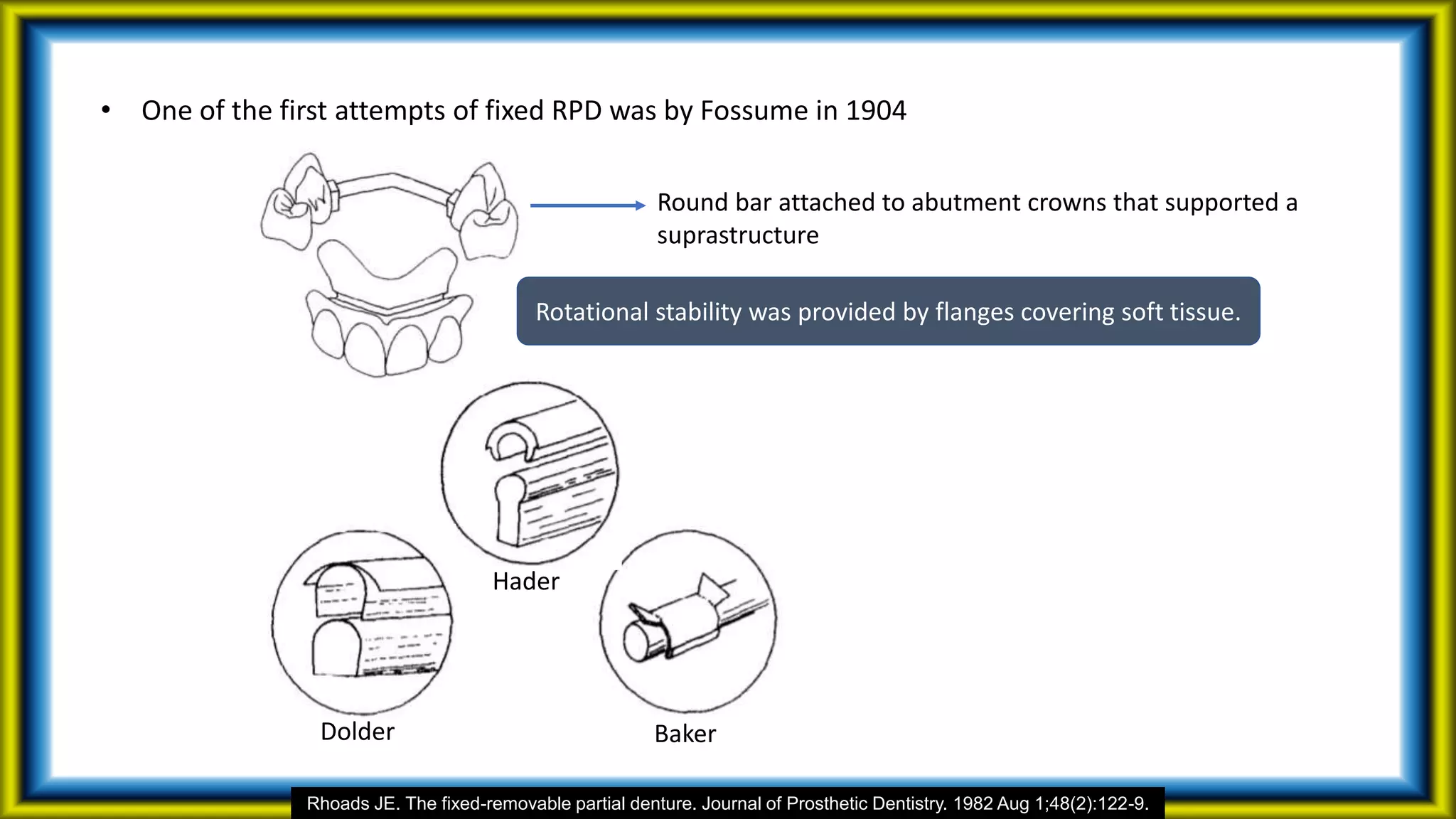 • One of the first attempts of fixed RPD was by Fossume in 1904
Round bar attached to abutment crowns that supported a
suprastructure
Rhoads JE. The fixed-removable partial denture. Journal of Prosthetic Dentistry. 1982 Aug 1;48(2):122-9.
Rotational stability was provided by flanges covering soft tissue.
Dolder
Hader
Baker
 