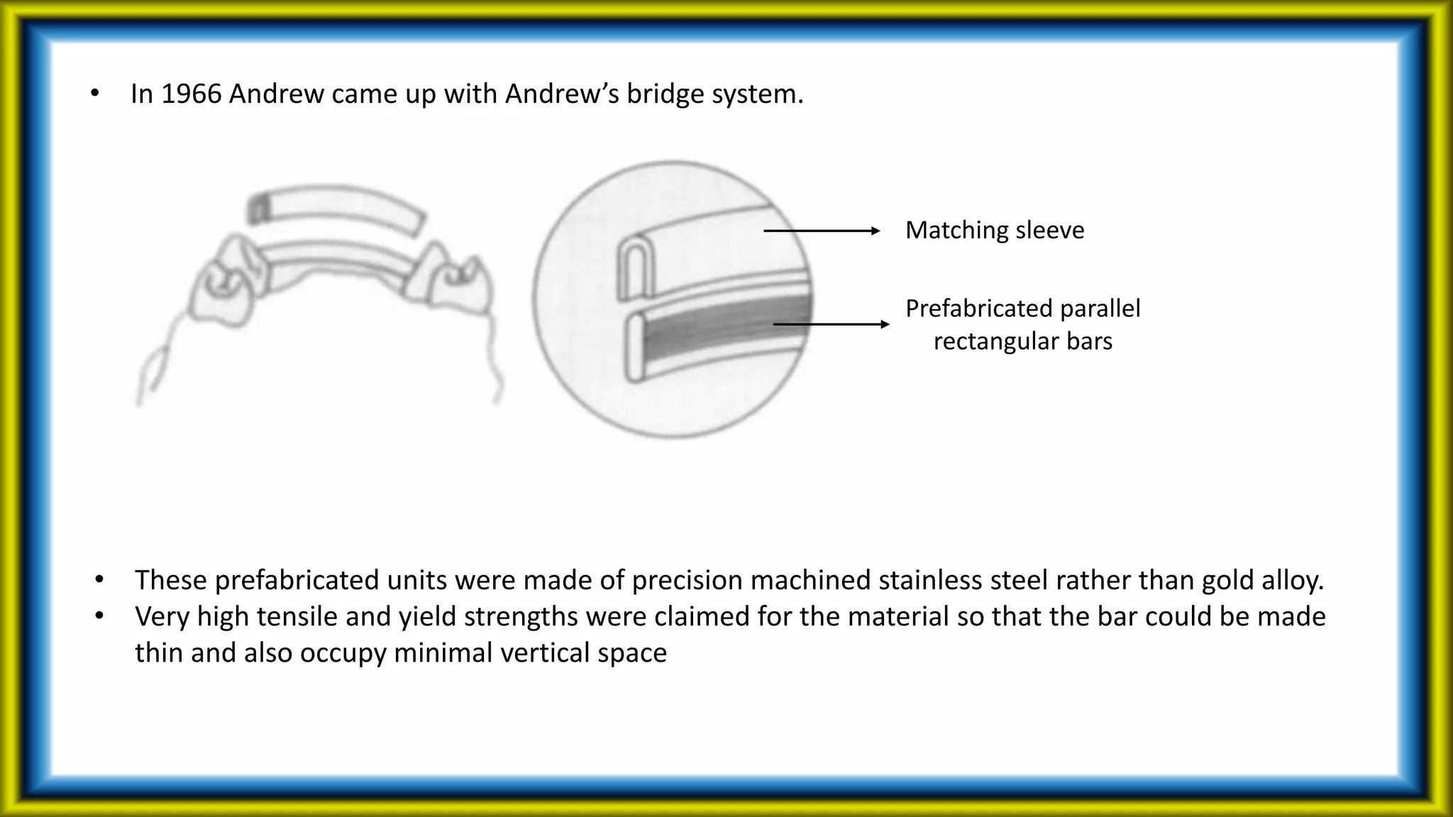• In 1966 Andrew came up with Andrew’s bridge system.
Prefabricated parallel
rectangular bars
Matching sleeve
• These prefabricated units were made of precision machined stainless steel rather than gold alloy.
• Very high tensile and yield strengths were claimed for the material so that the bar could be made
thin and also occupy minimal vertical space
 