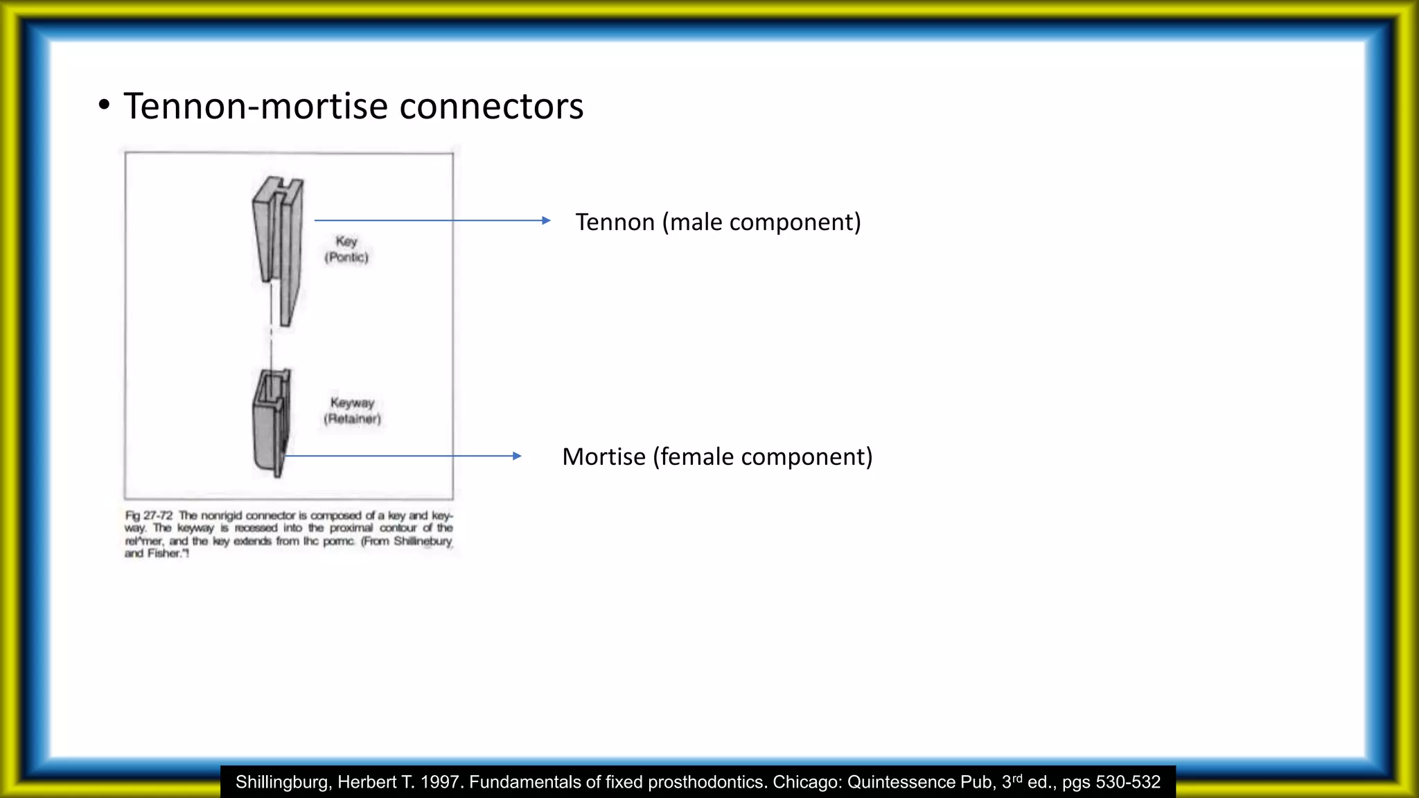 • Tennon-mortise connectors
Tennon (male component)
Mortise (female component)
Shillingburg, Herbert T. 1997. Fundamentals of fixed prosthodontics. Chicago: Quintessence Pub, 3rd ed., pgs 530-532
 