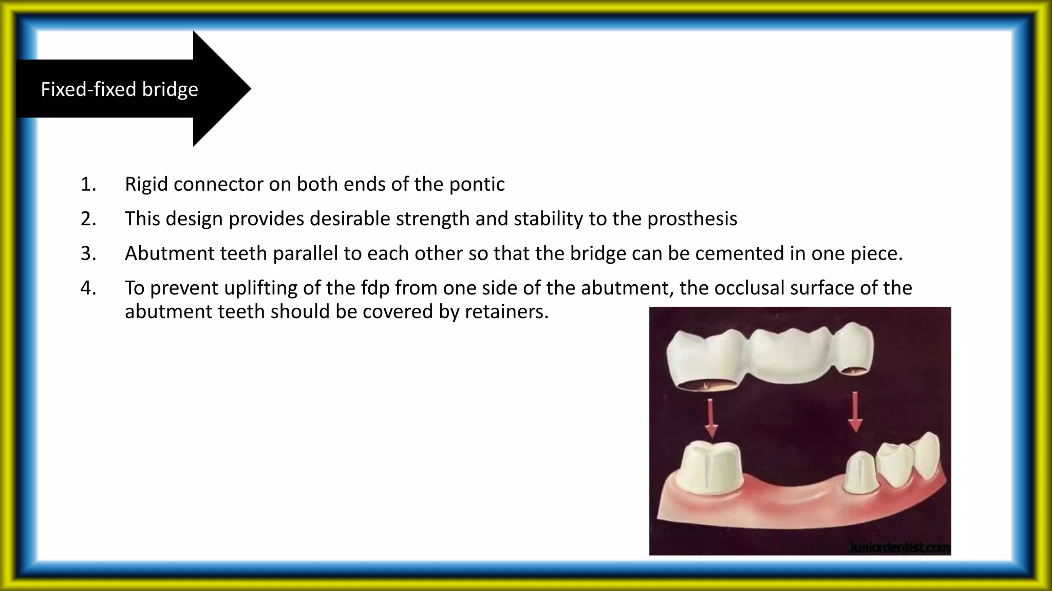 1. Rigid connector on both ends of the pontic
2. This design provides desirable strength and stability to the prosthesis
3. Abutment teeth parallel to each other so that the bridge can be cemented in one piece.
4. To prevent uplifting of the fdp from one side of the abutment, the occlusal surface of the
abutment teeth should be covered by retainers.
Fixed-fixed bridge
 