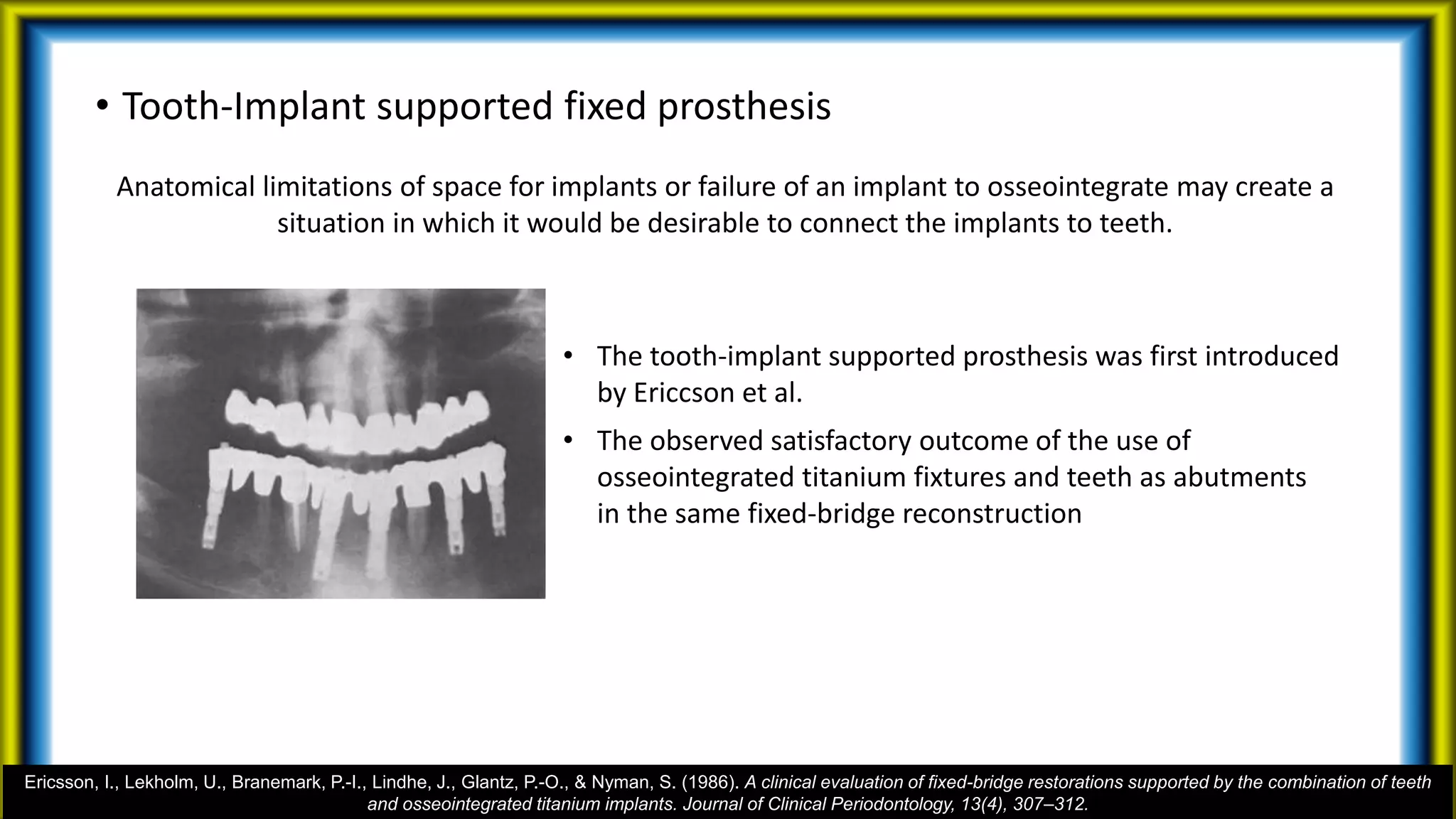 • Tooth-Implant supported fixed prosthesis
Anatomical limitations of space for implants or failure of an implant to osseointegrate may create a
situation in which it would be desirable to connect the implants to teeth.
• The tooth-implant supported prosthesis was first introduced
by Ericcson et al.
• The observed satisfactory outcome of the use of
osseointegrated titanium fixtures and teeth as abutments
in the same fixed-bridge reconstruction
Ericsson, I., Lekholm, U., Branemark, P.-I., Lindhe, J., Glantz, P.-O., & Nyman, S. (1986). A clinical evaluation of fixed-bridge restorations supported by the combination of teeth
and osseointegrated titanium implants. Journal of Clinical Periodontology, 13(4), 307–312.
 