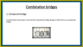Unconventional fixed partial dentures | PPTX