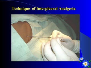 Unconventional modes of anaesthetic administration | PPT