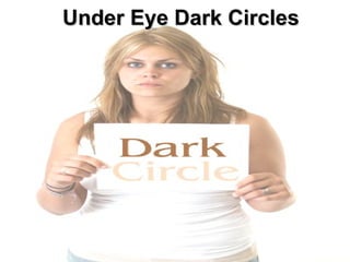 Under Eye Dark Circles 