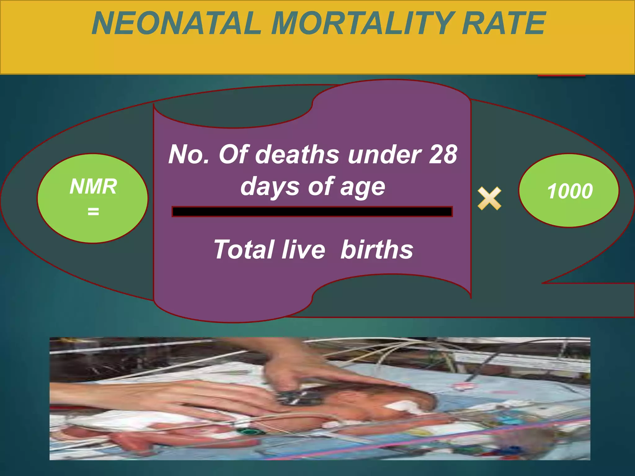 NEONATAL MORTALITY RATE
NMR
=
1000
No. Of deaths under 28
days of age
Total live births
 