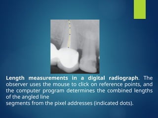 Comprehensive Overview of Digital Imaging in Radiography: Techniques ...