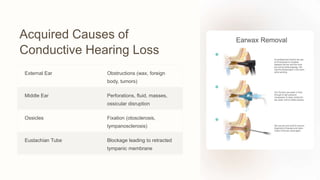 Acquired Causes of
Conductive Hearing Loss
External Ear Obstructions (wax, foreign
body, tumors)
Middle Ear Perforations, fluid, masses,
ossicular disruption
Ossicles Fixation (otosclerosis,
tympanosclerosis)
Eustachian Tube Blockage leading to retracted
tympanic membrane
 