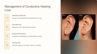 Management of Conductive Hearing
Loss
Obstruction Removal
Removal of canal obstructions like impacted wax or tumors.
Fluid Removal
Myringotomy with or without grommet insertion.
Surgical Interventions
Tympanotomy, stapedectomy, or tympanoplasty as needed.
Hearing Aids
Used when surgery is not possible, refused, or has failed.
 