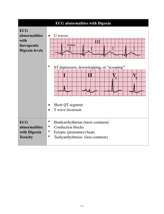 Understanding Medicine - Complete ECG Guide by Dr. Sam Gharbi | PDF