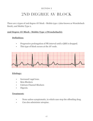 Understanding Medicine - Complete ECG Guide by Dr. Sam Gharbi | PDF