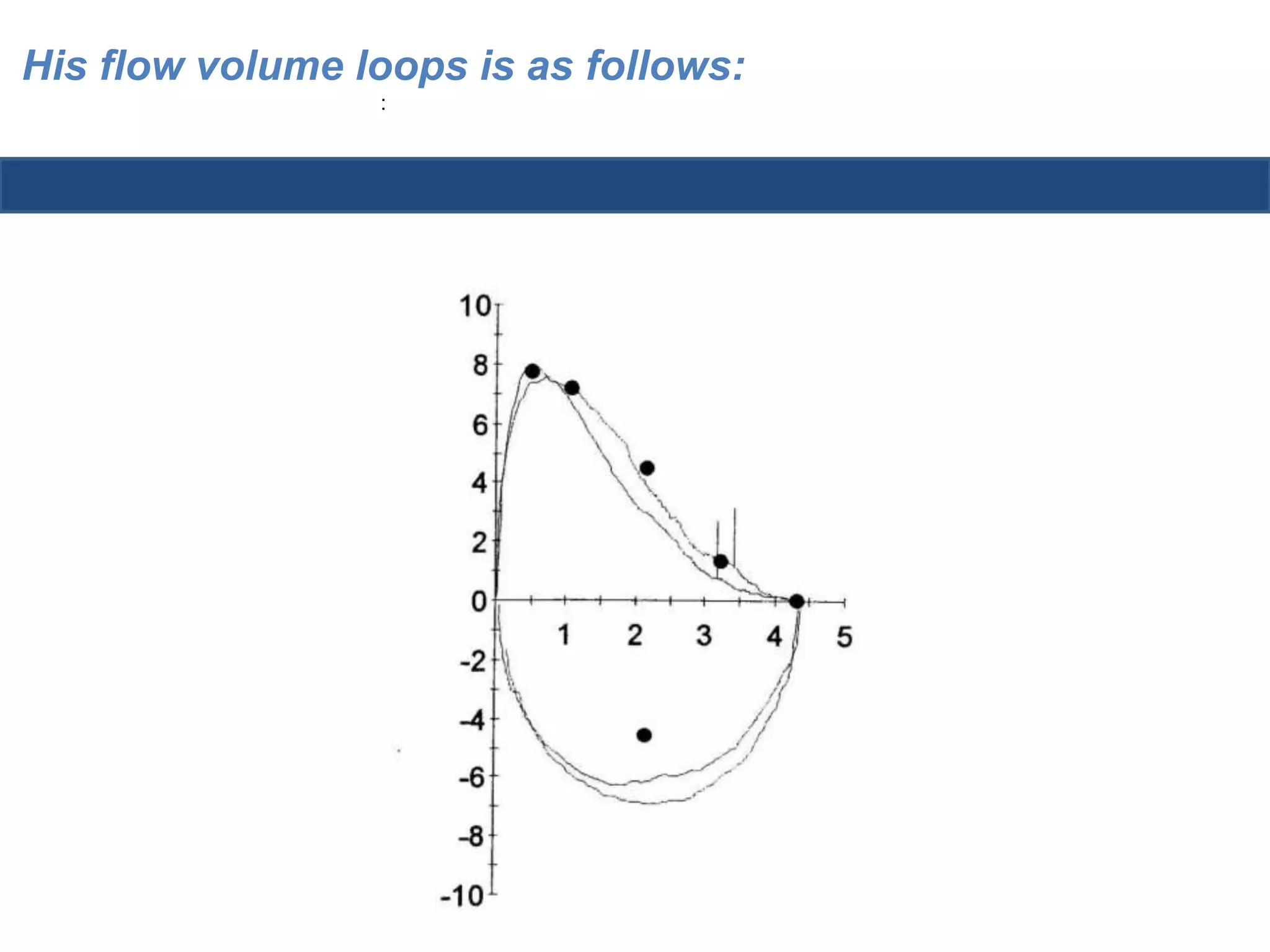 His flow volume loops is as follows: 
: 
 