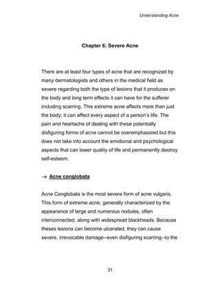 Understanding Acne
31
Chapter 6: Severe Acne
There are at least four types of acne that are recognized by
many dermatologists and others in the medical field as
severe regarding both the type of lesions that it produces on
the body and long term effects it can have for the sufferer
including scarring. This extreme acne affects more than just
the body; it can affect every aspect of a person’s life. The
pain and heartache of dealing with these potentially
disfiguring forms of acne cannot be overemphasized but this
does not take into account the emotional and psychological
aspects that can lower quality of life and permanently destroy
self-esteem.
 Acne conglobata
Acne Conglobata is the most severe form of acne vulgaris.
This form of extreme acne, generally characterized by the
appearance of large and numerous nodules, often
interconnected, along with widespread blackheads. Because
theses lesions can become ulcerated, they can cause
severe, irrevocable damage--even disfiguring scarring--to the
 