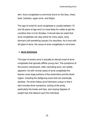 Understanding Acne
32
skin. Acne conglobata is commonly found on the face, chest,
back, buttocks, upper arms, and thighs.
The age of onset for acne conglobata is usually between 18
and 30 years of age and it is more likely for males to get the
condition than it is for females. It should also be noted that
acne conglobata can stay active for many years, lying
dormant until something causes it to resurface. As is true with
all types of acne, the cause of acne conglobata is not known.
 Acne fulminans
This type of severe acne is actually an abrupt onset of acne
conglobata that typically afflicts young men. The symptoms of
the severe nodulocystic, often ulcerating acne, are readily
apparent. As with normal cases of acne conglobata the
lesions cover large portions of the extremities and the facial
region, including the disfiguring scars that can eventually
develop. Yet what makes acne fulminans unique in that it
also includes fever symptoms, aching of the joints,
particularly the knees and hips, and varying degrees of
weight loss that depend upon the individual.
 