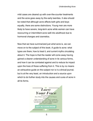 Understanding Acne
5
mild cases are cleared up with over-the-counter treatments
and the acne goes away by the early twenties. It also should
be noted that although acne affects both girls and boys
equally, there are some distinctions. Young men are more
likely to have severe, long-term acne while women can have
reoccurring or intermittent acne well into adulthood due to
hormonal changes and cosmetics.
Now that we have summarized just what acne is, we can
move on to the subject of this book. A guide to acne: what
types are there, how to treat it, and current myths circulating
about it. The hope is that the reader will come away having
gained a clearer understanding of acne in its various forms,
and how it can be combated against and to reduce its impact
upon the lives of those suffering from it. This is by no means
an exhaustive guide on the subject nor is it a clinical journal,
but is at the very least, an introduction and a source upon
which to do further study into the causes and cures of acne in
all its forms.
 