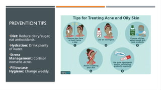 understanding acne: types, risk factors ,treatment.pptx