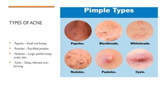 understanding acne: types, risk factors ,treatment.pptx