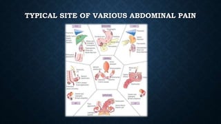TYPICAL SITE OF VARIOUS ABDOMINAL PAIN
 