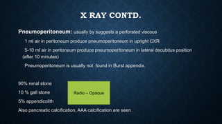 X RAY CONTD.
Pneumoperitoneum: usually by suggests a perforated viscous
1 ml air in peritoneum produce pneumoperitoneum in upright CXR
5-10 ml air in peritoneum produce pneumoperitoneum in lateral decubitus position
(after 10 minutes)
Pneumoperitoneum is usually not found in Burst appendix.
90% renal stone
10 % gall stone
5% appendicolith
Also pancreatic calcification, AAA calcification are seen.
Radio – Opaque
 