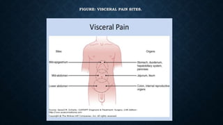 FIGURE: VISCERAL PAIN SITES.
 