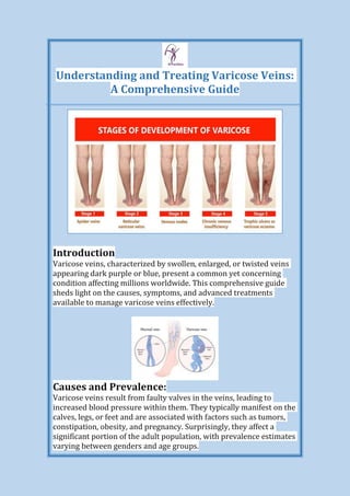 Understanding and Treating Varicose Veins:
A Comprehensive Guide
Introduction
Varicose veins, characterized by swollen, enlarged, or twisted veins
appearing dark purple or blue, present a common yet concerning
condition affecting millions worldwide. This comprehensive guide
sheds light on the causes, symptoms, and advanced treatments
available to manage varicose veins effectively.
Causes and Prevalence:
Varicose veins result from faulty valves in the veins, leading to
increased blood pressure within them. They typically manifest on the
calves, legs, or feet and are associated with factors such as tumors,
constipation, obesity, and pregnancy. Surprisingly, they affect a
significant portion of the adult population, with prevalence estimates
varying between genders and age groups.
 