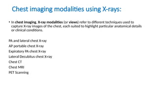 Comprehensive Guide to Understanding and Interpreting X-rays in Medical ...