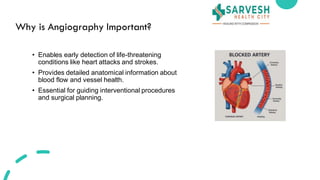 Angi Test Understanding Angiography: How This Test Saves Lives | PDF